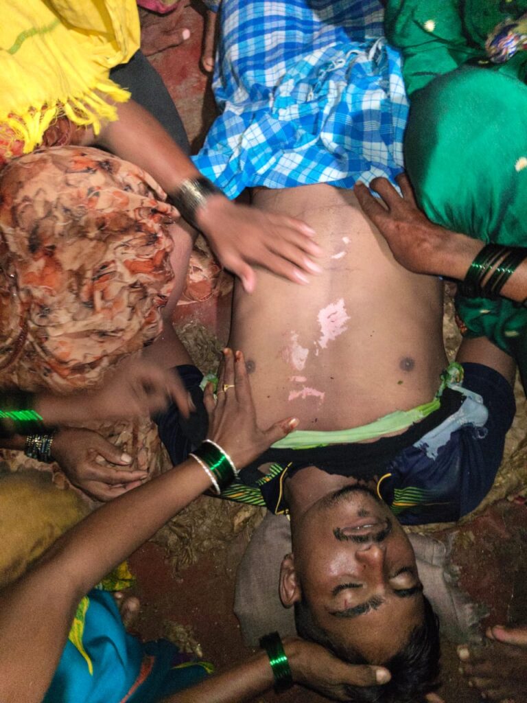 ಸಿಡಿಲು ಬಡಿದು ಕುರಿಗಾಹಿ ಯುವಕ ಸಾವು